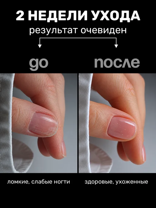 infi Укрепитель для ногтей с микроблеском, белый, фото 2