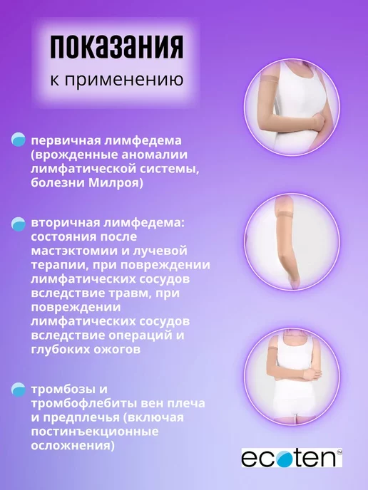 ОРТОПЕДИК Рукав компрессионный противоотечный 1 класс компрессии, бежевый, фото 3