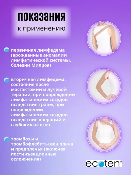ОРТОПЕДИК Рукав компрессионный с ремнем 2 класс компрессии от отека, бежевый, фото 3