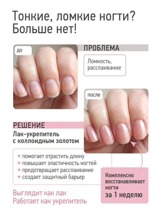 IQ BEAUTY Укрепитель ногтей с коллоидным золотом Gold Hardener, Blush, золотой, фото 2