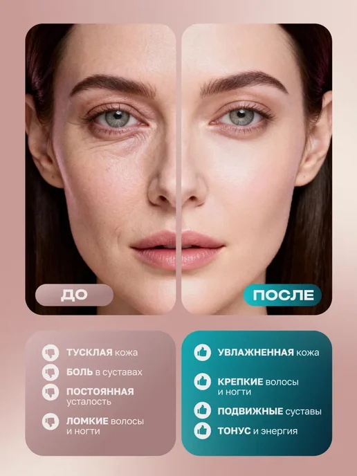 Первый Живой Коллаген Живой коллаген пищевой продукт для суставов, 500 мл, фото 4
