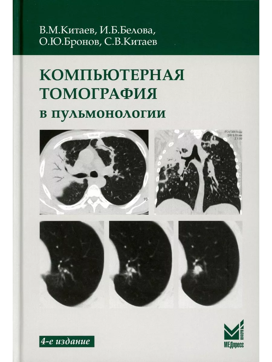 Компьютерная томография в пульмонологии. 4-е изд МЕДпресс-информ 196204847  купить за 1 674 ₽ в интернет-магазине Wildberries