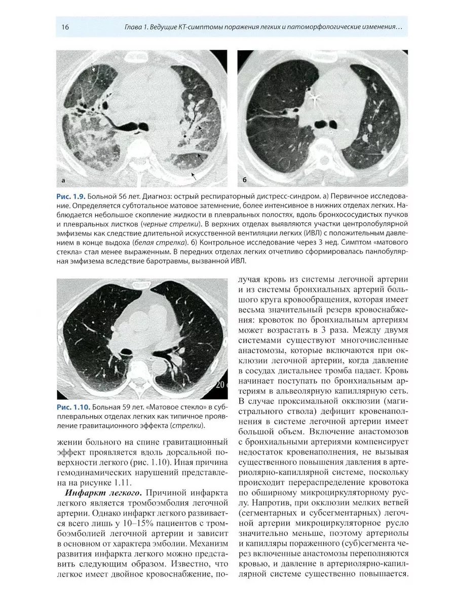 Компьютерная томография в пульмонологии. 4-е изд МЕДпресс-информ 196204847  купить за 1 693 ₽ в интернет-магазине Wildberries