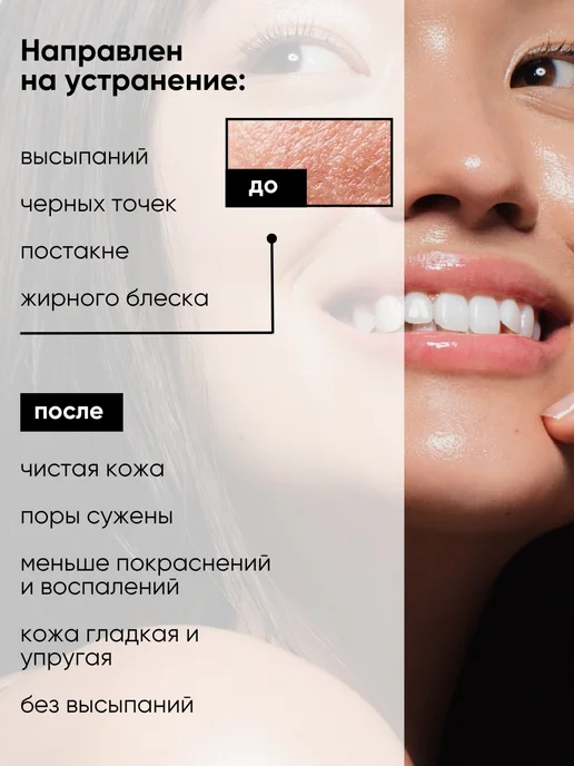La & Te beauté Тоник для лица увлажняющий очищающий для сухой кожи, 200 мл, Успокаивающий жирной с Aha-кислотами, фото 6