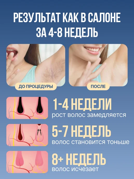 LUM AUS Фотоэпилятор для удаления волос домашний мини, белый, фото 2