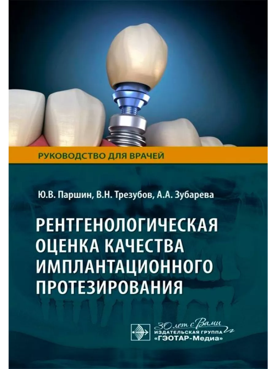 Рентгенологическая оценка качества имплантационного ГЭОТАР-Медиа 198166517  купить за 597 ₽ в интернет-магазине Wildberries