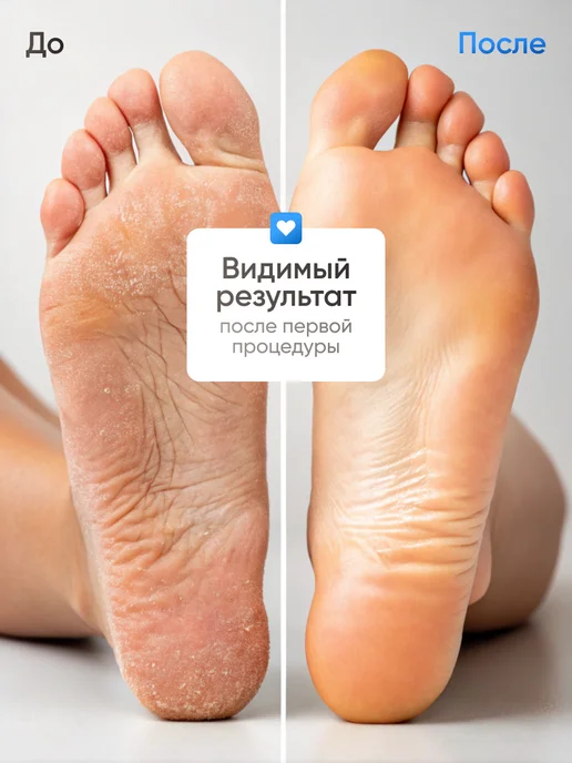 Nails28 Смарт диск для педикюра 20 мм и набор файлов и фрез m, 81 шт, фото 2