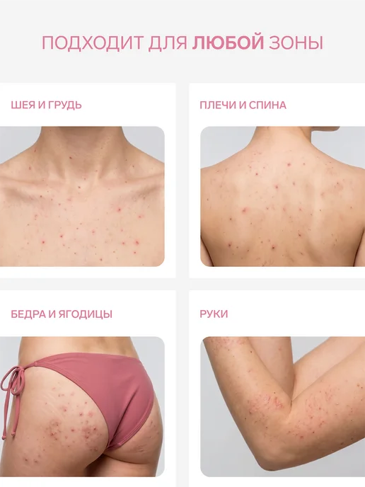 EVSI Салициловый гель для душа от прыщей и акне, вариант, фото 2