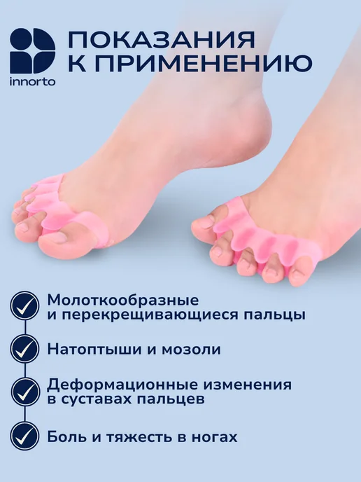 INNORTO Разделители для пальцев ног 52169, розовый, фото 2