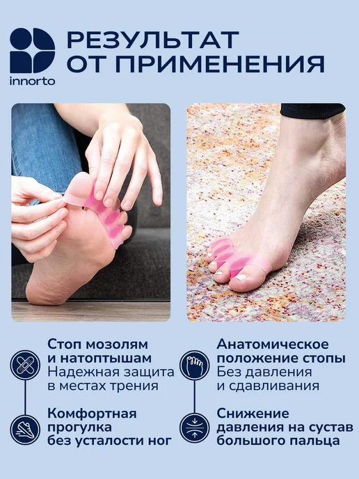 INNORTO Разделители для пальцев ног 52169, розовый, фото 3