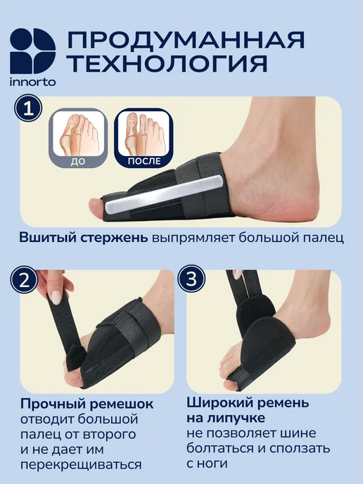 INNORTO Вальгусные шины от косточек на ногах, черный, фото 2