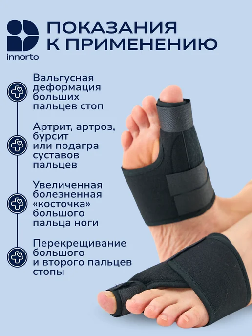 INNORTO Вальгусные шины от косточек на ногах, черный, фото 3