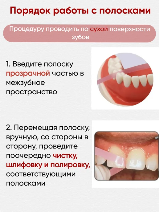ТОР ВМ Полоски 75 шт. стоматологические штрипсы 1.055, 75 шт, фото 4