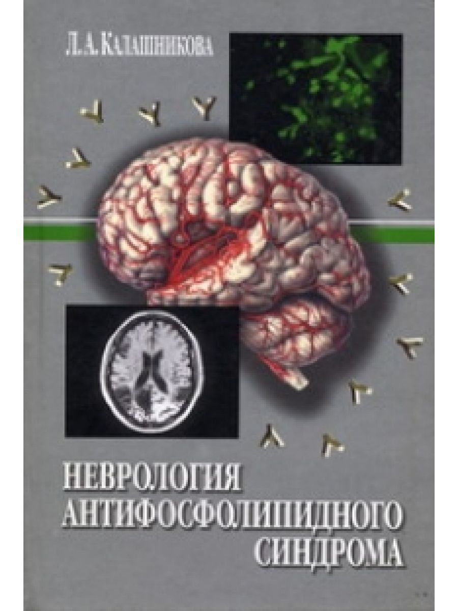 Антифосфолипидный синдром неврология. Неврология книги. Учебник по неврологии. Монографии по неврологии.