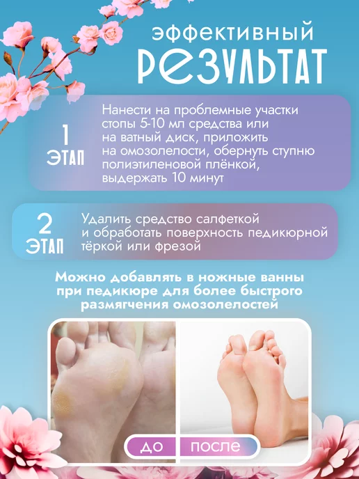 Sagitta Кератолитик для педикюра, 1 л, фото 4
