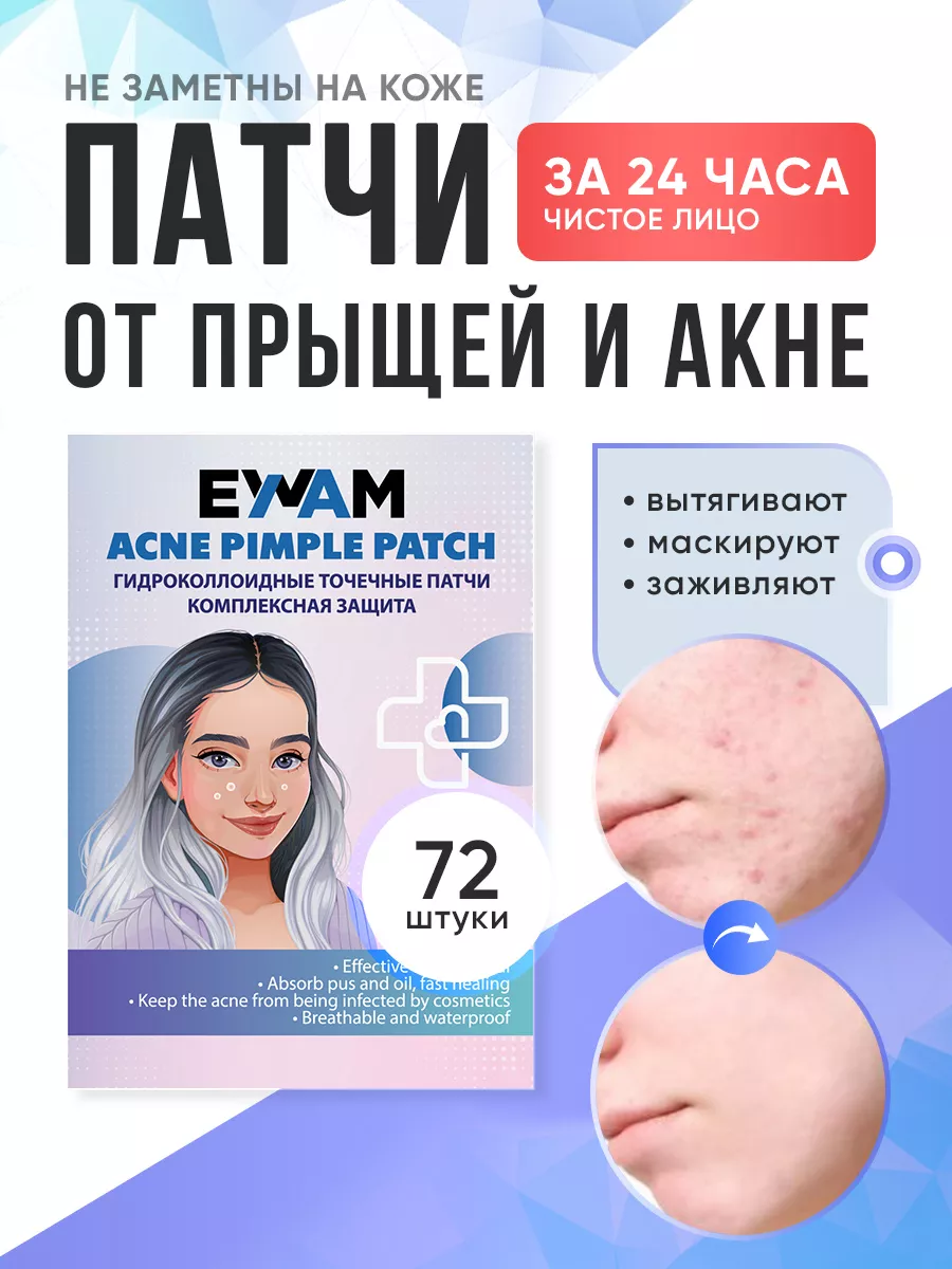 Патчи против прыщей...