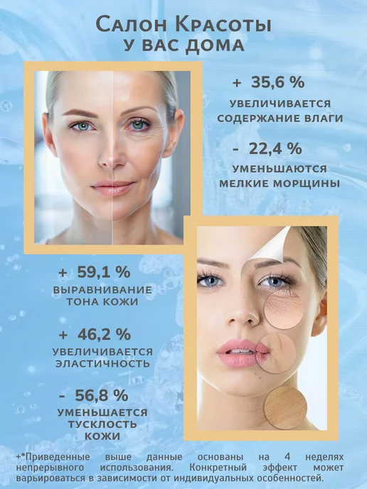 K.KlARA Массажер для лица от отеков, желтый, фото 3